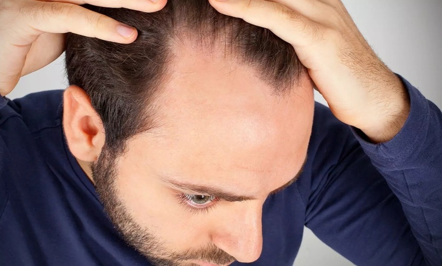 Image 2:  66% Off PRP Injections for Full Face or Hair Restoration