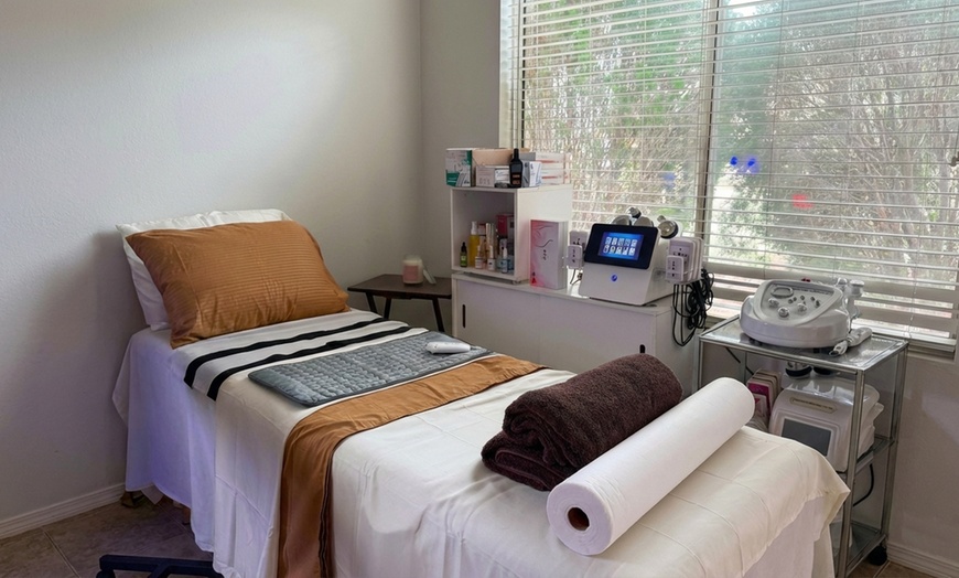Image 2: 1 or 3 20 Min RF for Hands & Feet or 35-Min RF w/ Cavitation Sessions