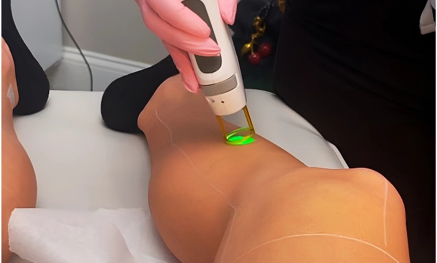 Image 1: Up to 77% Off on IPL Hair Removal at Bare Beauty Aesthetics