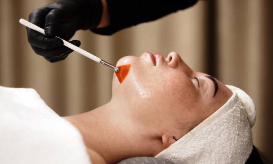 Image 3: One or Three Sessions: Polynucleotide Under Eye or Full-Face Treatment