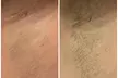 Get One Year of Unlimited Laser Hair-Removal Sessions for One, Two or Three Areas at Xscape Massage And Spa - Second Medium