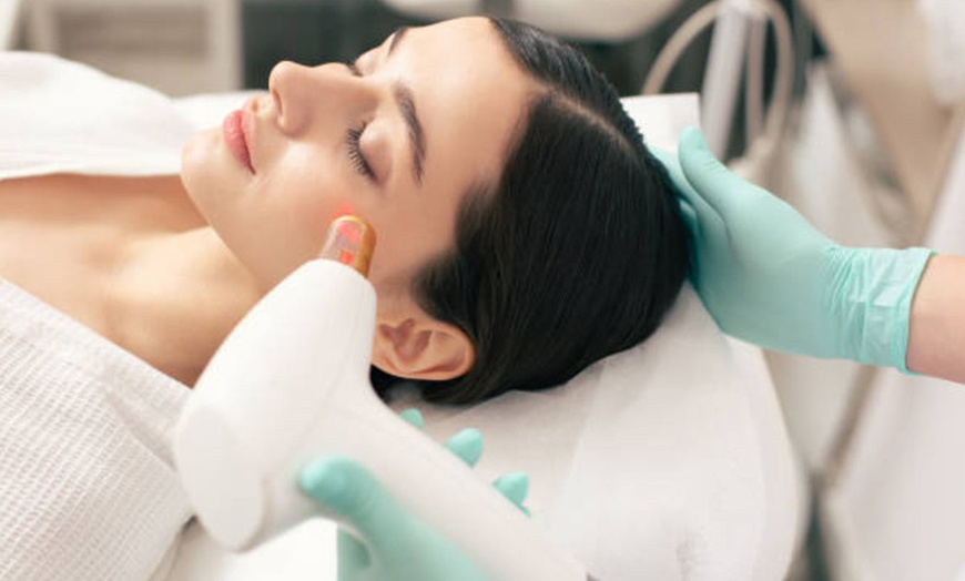 Image 4: Rejuvenecimiento facial con láser y velo de colágeno luminoso