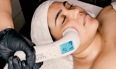 For One Person: 90-Minute Rejuvenate Pamper Package Includes Microdermabrasion - Shanam Skincare