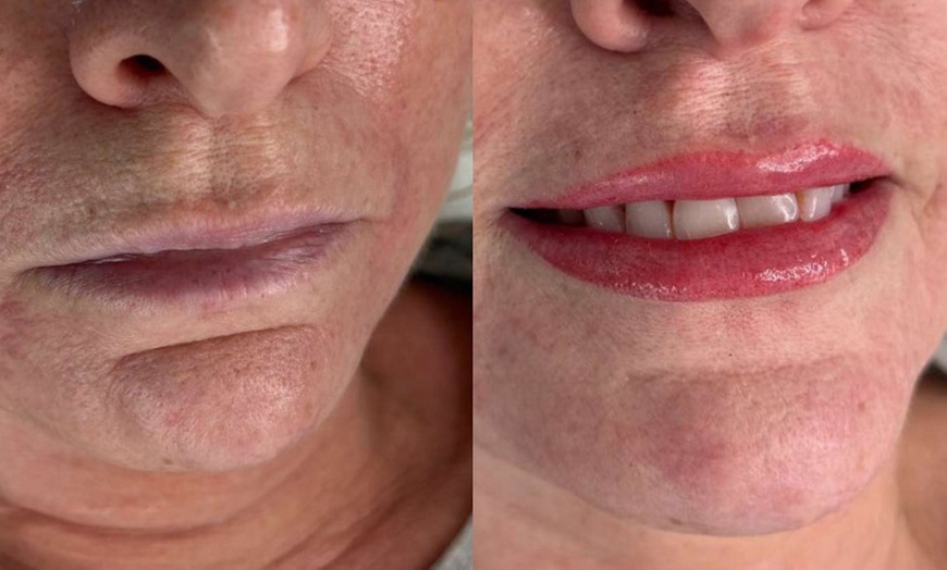 Image 2: One Lip Blush Micropigmentation Session with Optional 4 Weeks Touch Up