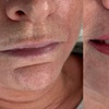 Image 2: One Lip Blush Micropigmentation Session with Optional 4 Weeks Touch Up