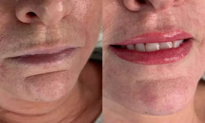One Lip Blush Micropigmentation Session with Optional 4 Weeks Touch Up