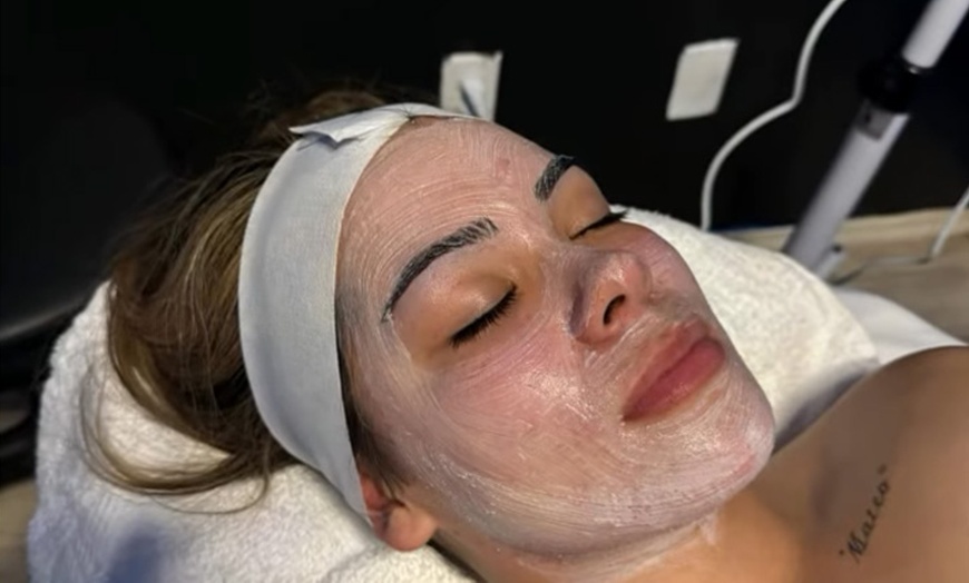 Image 9: Rejuvenate with One, Three, or Five Sessions of 60 Min Custom Facial! 