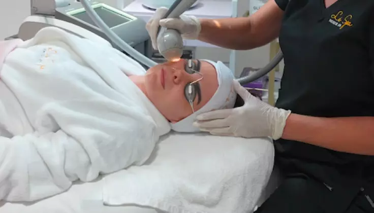 Glow Brighter: Up to  66%  Off IPL Photo Facials