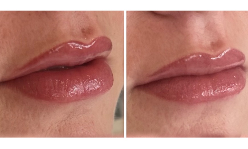 Image 7: Langdurige beauty-upgrades voor je wenkbrauwen, wimpers of lippen