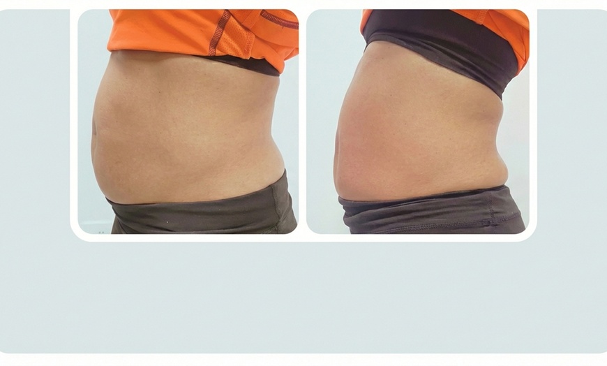 Image 2: One or Three Fat Reduction Treatments with Venus Bliss Max