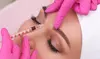 Say Goodbye to Wrinkles with 20, 40, or 60 Units of Xeomin at The Skin Room (Up to 38% Off)