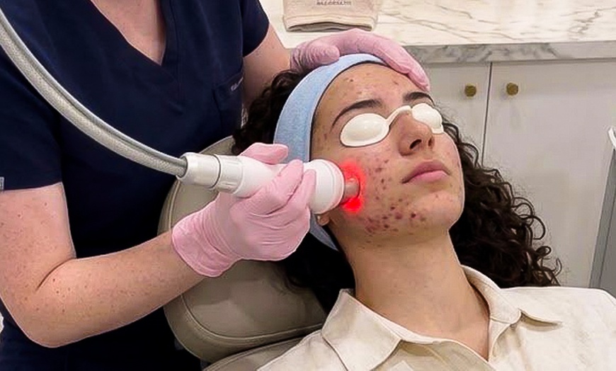Image 2: Fractional Laser Skin Resurfacing for Face or Neck: 1 or 3 Treatments