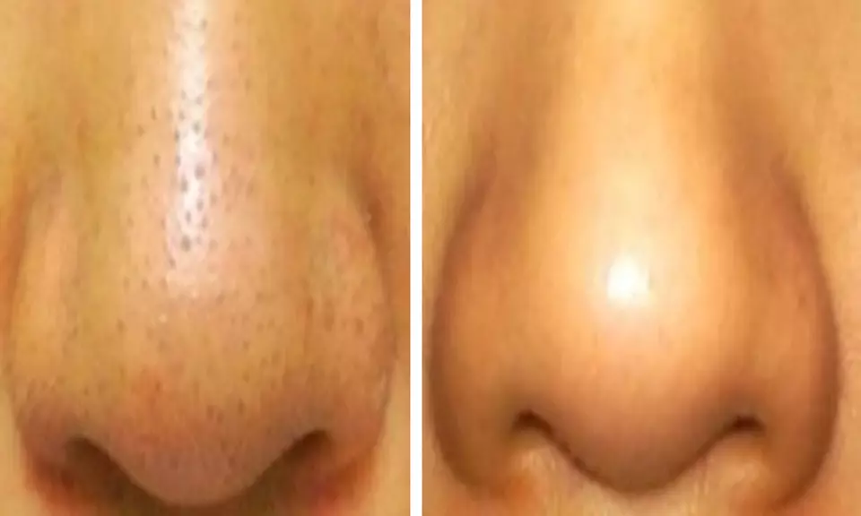 Glow & Sculpt: Body Wrap + Facial with  Optional LED Light Boost