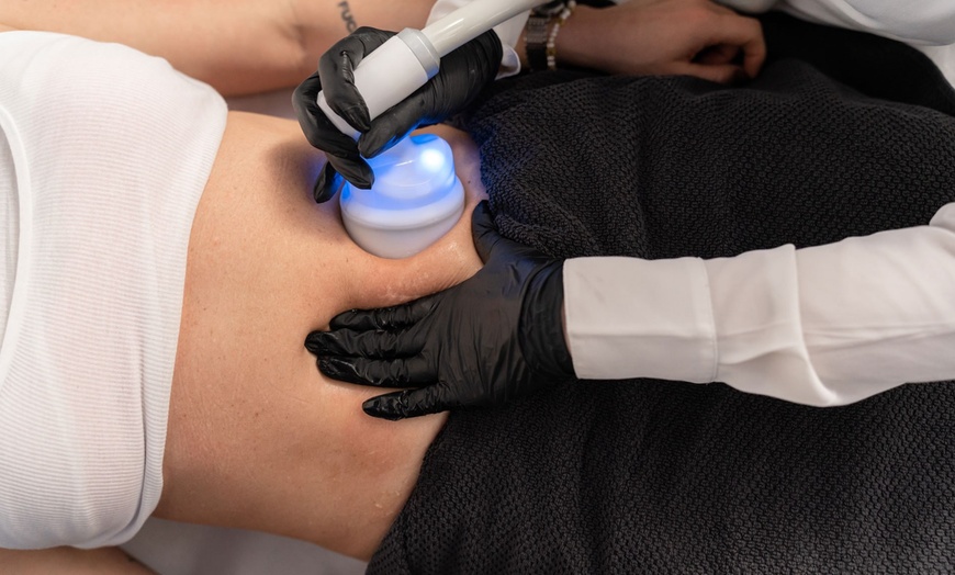 Image 2: Bis zu 48% Rabatt auf den Kältetherapie bei Good Vibes Cologne