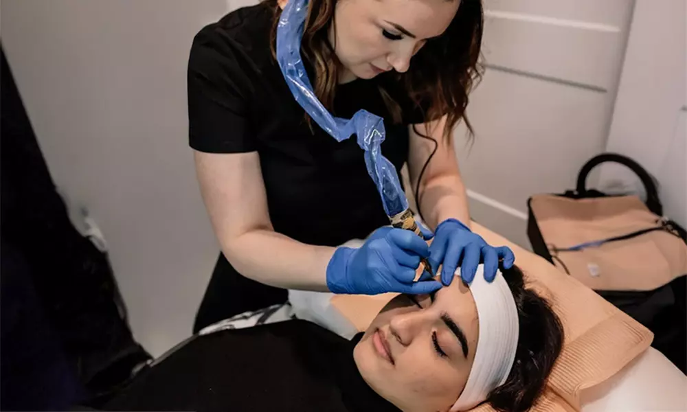 30-Minute One, Two, or Three Alma TED Hair Restoration Sessions