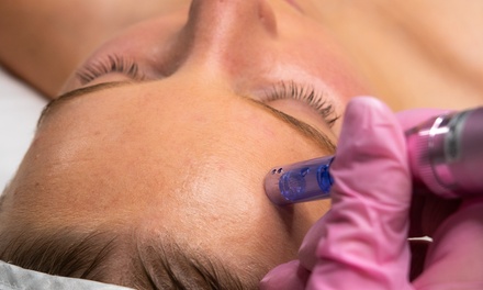 Skin Rejuvenation Duo: Microneedling + LED Light Therapy - Mona Vale Skin and Laser