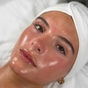 Image 1: Radiant Skin Awaits: Signature & Platinum Hydrafacial Packages