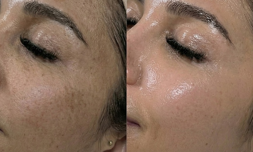 Image 21: Unifiez votre teint avec un soin anti-taches ciblé 5G Removal