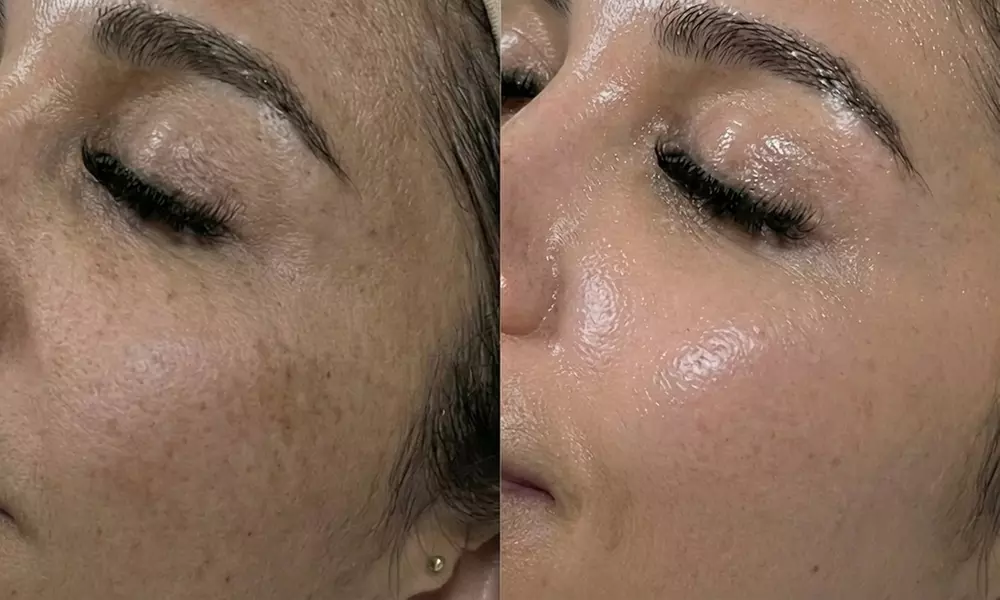 Unifiez votre teint avec un soin anti-taches ciblé 5G Removal