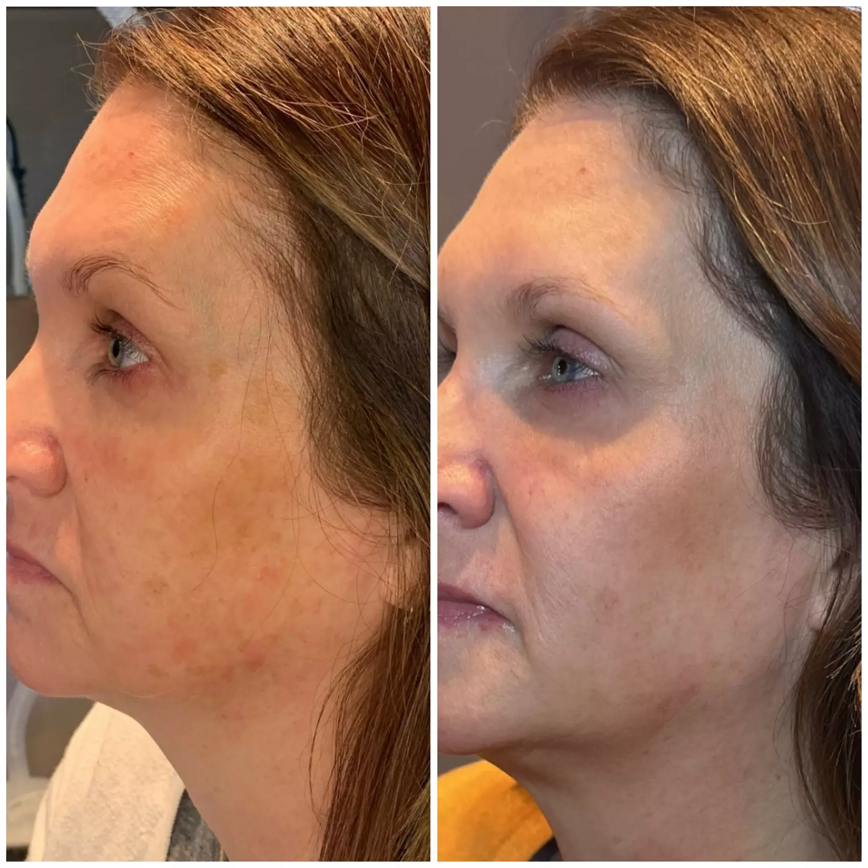 ONLY Genuine BOTOX® 20, 40, or 60 Units!