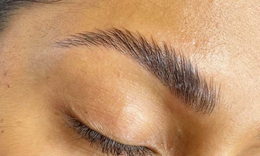 Image 6: Microneedling et peeling d'1h