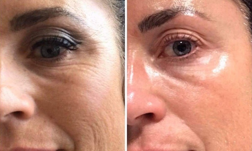 Image 5: Hydratation intense et fermeté du visage