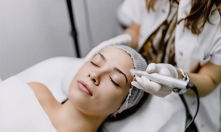 1x microneedling behandeling van 60 minuten - Beautycare Tara