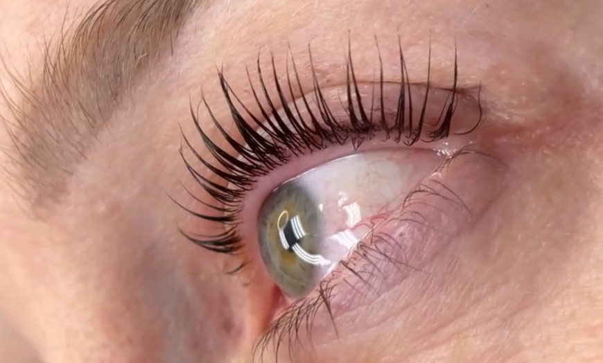 Image 11: CO2 Skin Rejuvenation for Face, Neck, & Eyes