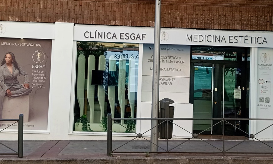 Image 4: Tratamiento de relleno dérmico con infiltración en una zona facial 