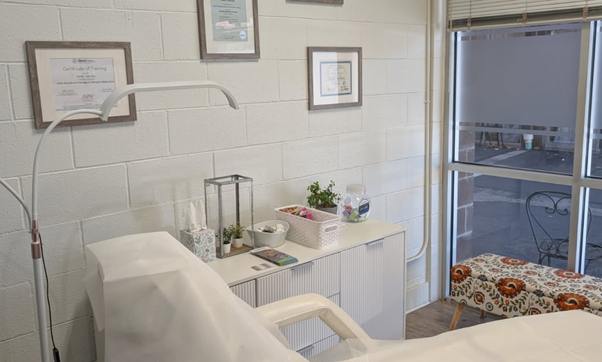 Image 4: Comprehensive Scalp Micro Needling Session -One, Three or Five 60 Min 