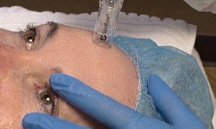 One Micro-Needling Treatment  ZO Skin Health Firming Serum - Ageless and Beautiful
