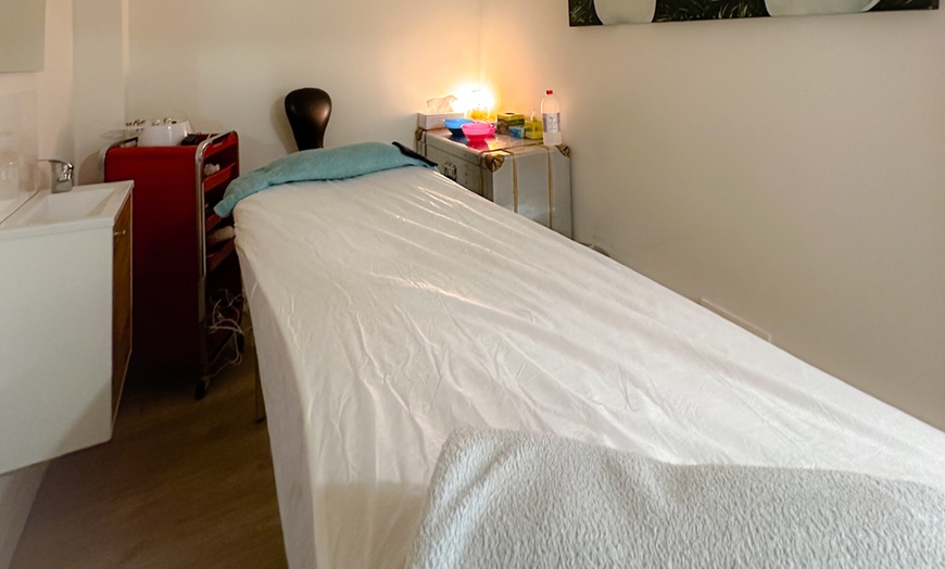 Image 9: Tratamiento facial con infiltración de ADN de esperma de salmón