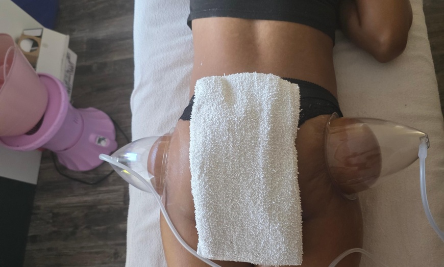 Image 3: BBL Butt Therapy Treatment at Pink Caramel Boutique and Body Bar