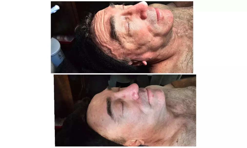 Revitalize Your Skin with a HydroFacial Experience