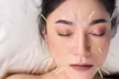 Boost Wellness with One, Two or Three 60 Min Choice of Acupuncture Sessions at HealthBay Wellness (Up to 36%Off) - Second Medium