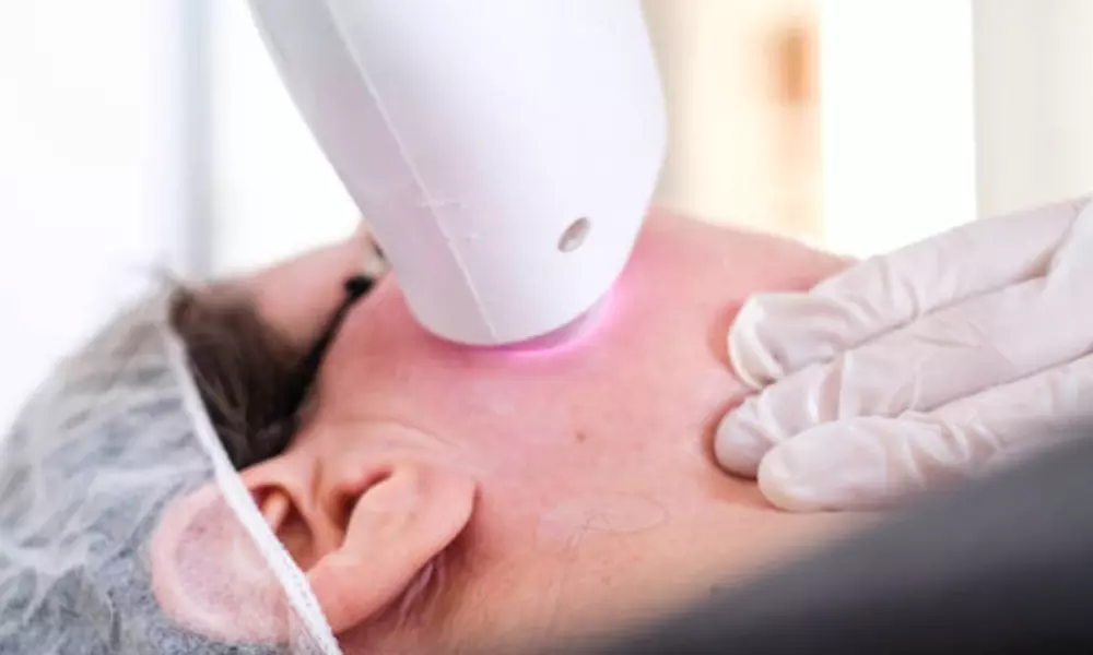 Rejuvenecimiento facial con láser y velo de colágeno luminoso
