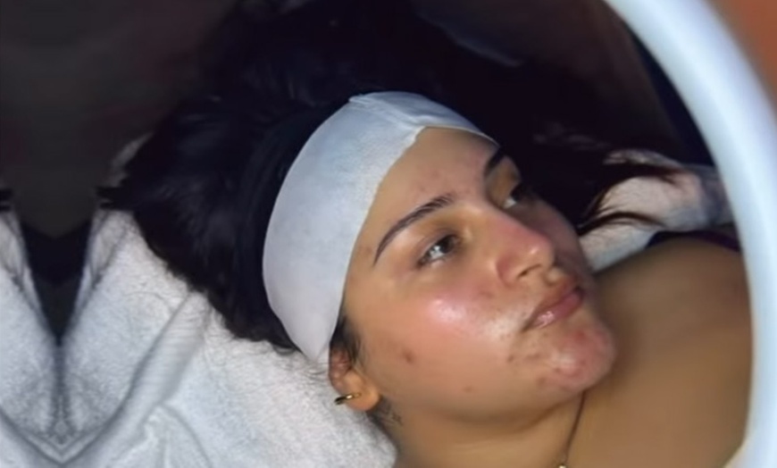Image 2: Rejuvenate with One, Three, or Five Sessions of 60 Min Custom Facial! 