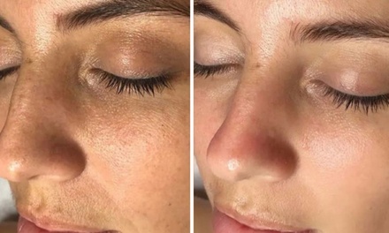 Signature Hydrogen-Behandlung: Tiefenreinigung & Feuchtigkeit für 1 Person - Body and Soul Massagestudio