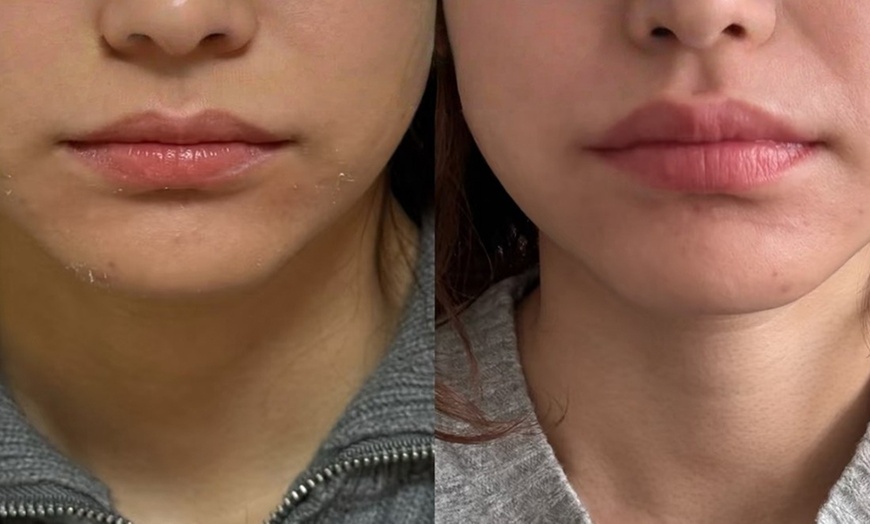 Image 3: Advanced Skin Rejuvenation & Body Contouring