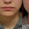 Image 3: Advanced Skin Rejuvenation & Body Contouring