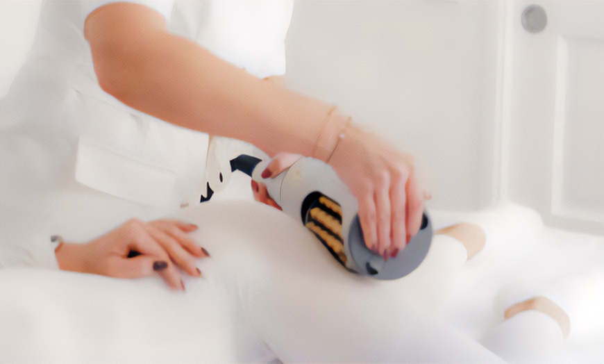 Image 1: 1-3x 60 Min. Anti-Cellulite-Massage mit Stratosphere für 1 Person