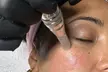 Microneedling facial con vitaminas en rostro completo con opción a cuello y escote para 1 persona al 60% - Second Medium