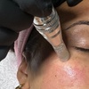 Image 5: Microneedling con vitaminas en rostro, cuello y escote para 1 persona