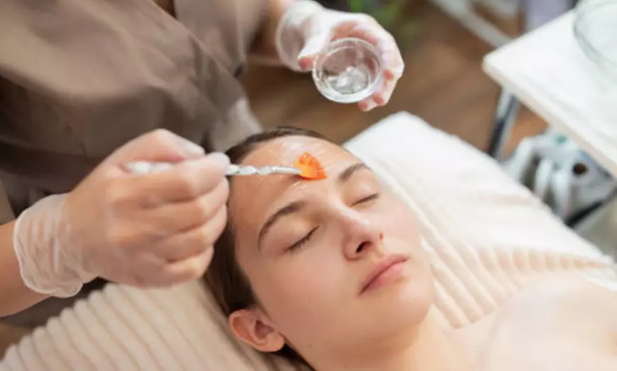 Image 4: Hollywood peeling con carbón activo y láser o limpieza facial prémium 