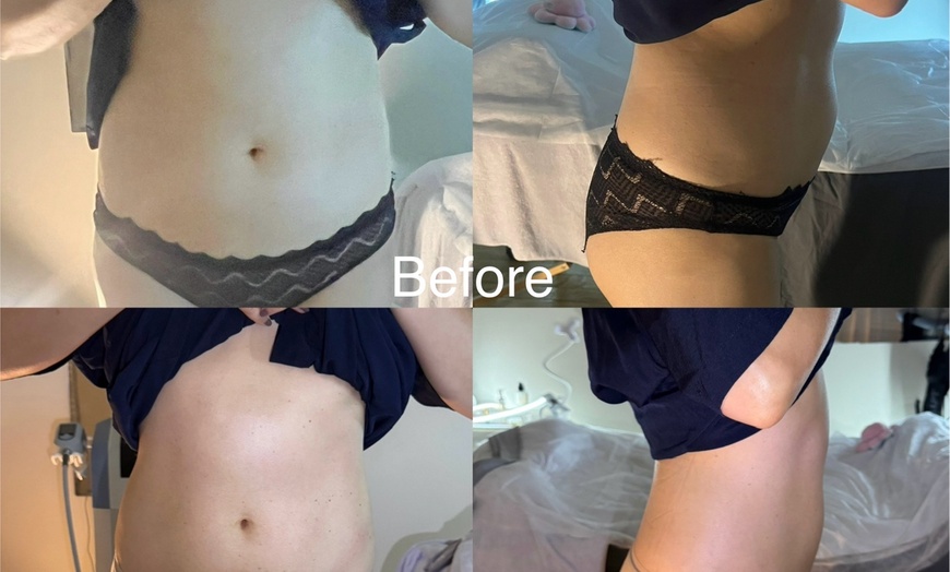 Image 5: Up to 70% Off on Ultrasonic Fat Reduction