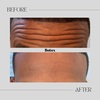 Image 5: Smooth Fine Lines & Wrinkles with Professional Botox Injections
