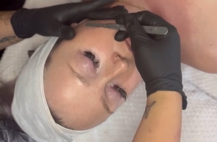 One Dermaplane Treatment - NuSpa Skin and Wellness Clinic