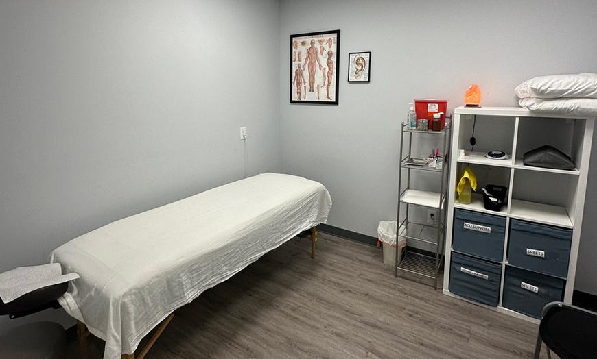 Image 2: Boost Wellness with One, Two, or Three Acupuncture Sessions