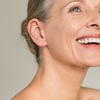 Image 3: Up to 65% Off on Radio Frequency Skin Tightening at Promedic Laser & Skin