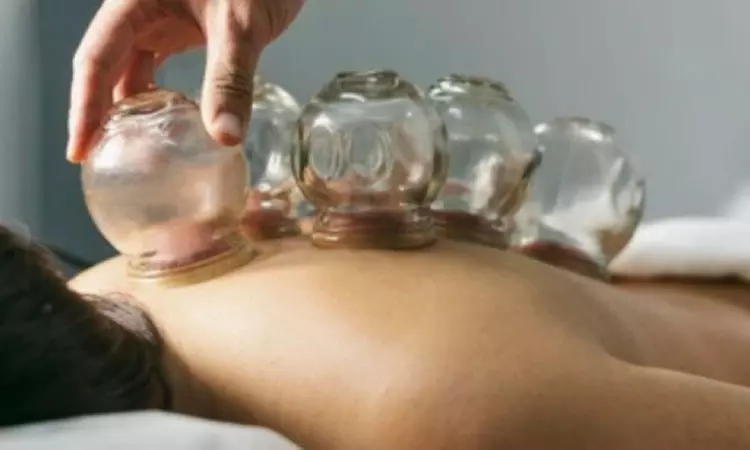 20-Minute 1, 3, or 5 Combination Cupping Sessions: (Wet, Dry & Moving)